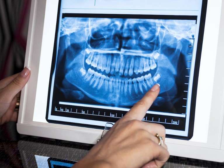 Panoramic X-Rays in hampton park